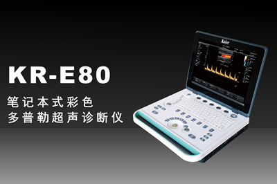 國(guó)產(chǎn)彩超機(jī)購(gòu)買需要關(guān)注的事項(xiàng)